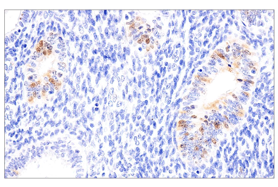 Immunohistochemistry Image 9: Chk1 (2G1D5) Mouse mAb