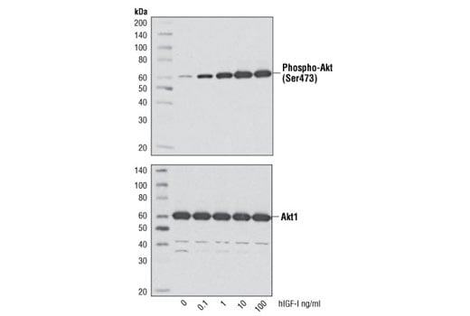 undefined Image 4: Human Insulin-like Growth Factor I (hIGF-I)