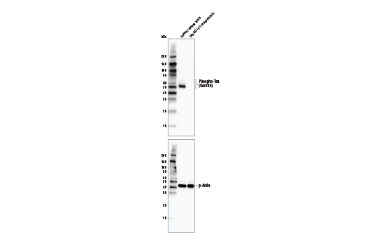 undefined Image 5: Pathological Hallmarks of Alzheimer's Disease Antibody Sampler Kit