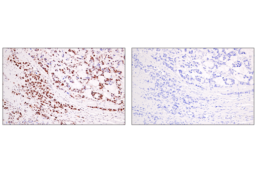 Immunohistochemistry Image 2: DEK (E4S5J) Rabbit Monoclonal Antibody