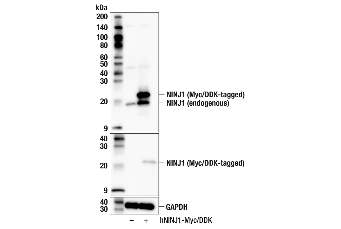 Western Blotting Image 2: NINJ1 (F2Y6T) Rabbit Monoclonal Antibody
