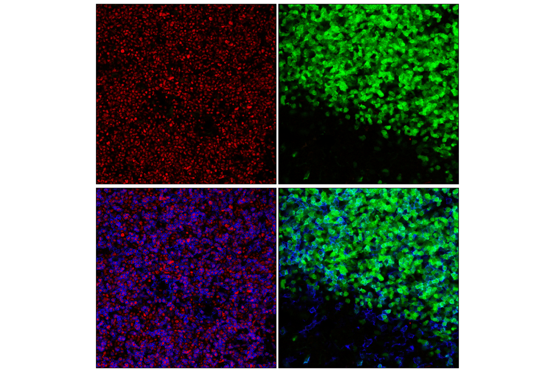 Immunofluorescence Image 1: TCF1/TCF7 (C63D9) Rabbit Monoclonal Antibody (BSA and Azide Free)