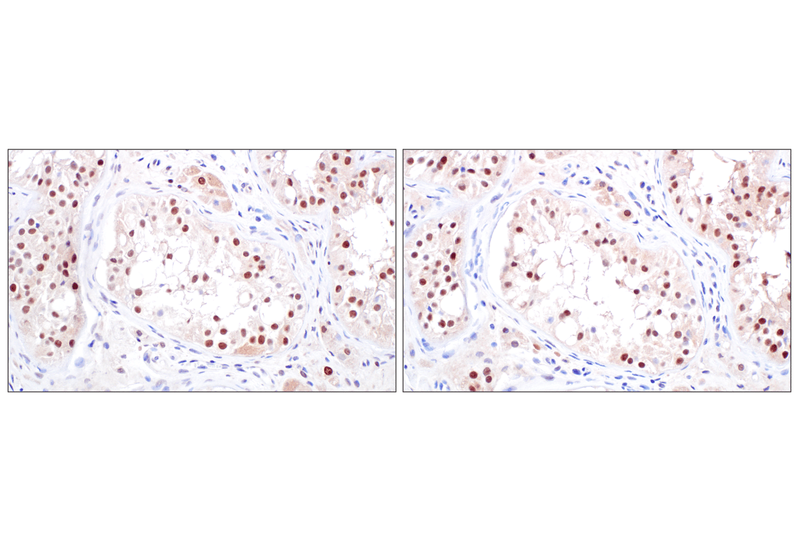 Immunohistochemistry Image 12: TFE3 (F3Z2Q) Rabbit Monoclonal Antibody