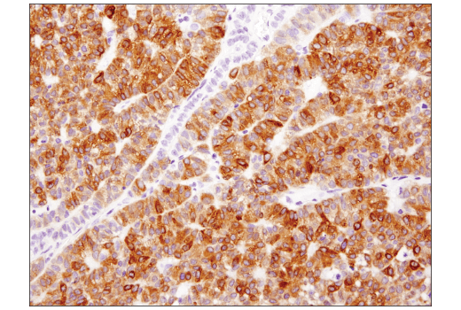 Immunohistochemistry Image 1: Aromatase (D5Q2Y) Rabbit Monoclonal Antibody