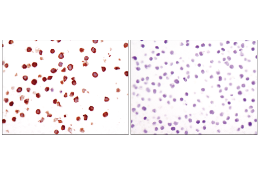 Immunohistochemistry Image 5: Btk (D3H5) Rabbit Monoclonal Antibody (BSA and Azide Free)