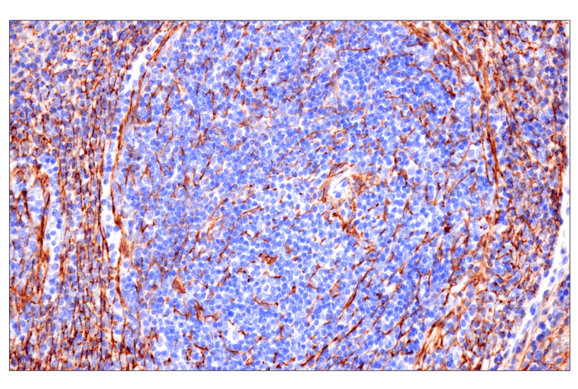Immunohistochemistry Image 14: Desmin (F5V4I) Rabbit Monoclonal Antibody