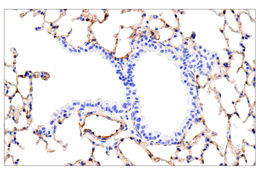 Immunohistochemistry Image 2: MCAM (E3F3E) Rabbit Monoclonal Antibody (BSA and Azide Free)