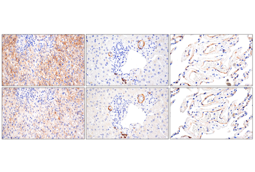 Immunohistochemistry Image 4: NG2/CSPG4 (E3B3G) Rabbit Monoclonal Antibody