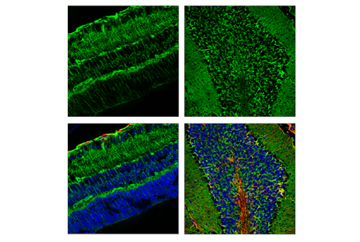 Immunofluorescence Image 1: AQP4 (D1F8E) Rabbit Monoclonal Antibody