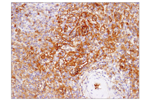 Immunohistochemistry Image 3: IFIT1 (D2X9Z) Rabbit Monoclonal Antibody (BSA and Azide Free)