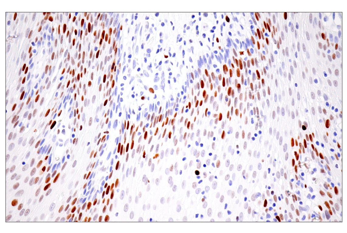 Immunohistochemistry Image 11: UHRF1 (E5W8W) Rabbit Monoclonal Antibody