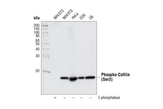 undefined Image 12: Actin Reorganization Antibody Sampler Kit