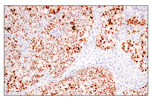 Immunohistochemistry Image 3: p14 ARF (E3X6D) Rabbit mAb (BSA and Azide Free)