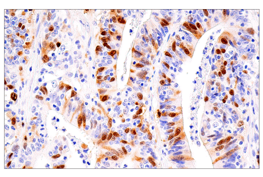 Immunohistochemistry Image 2: Cyclin A2 (E6D1J) Rabbit Monoclonal Antibody