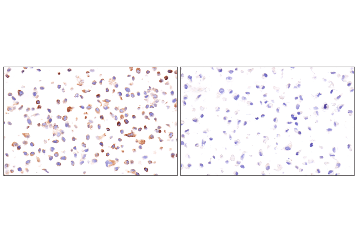 Immunohistochemistry Image 15: AMACR (F7T6V) Rabbit Monoclonal Antibody