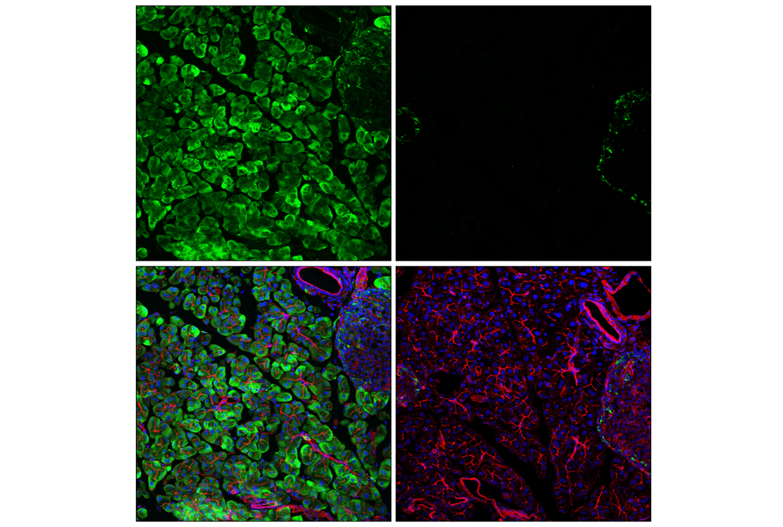 undefined Image 37: Translational Control Antibody Sampler Kit