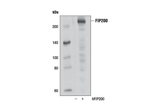 undefined Image 14: Autophagy Induction (ULK1 Complex) Antibody Sampler Kit
