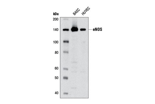 Western Blotting Image 1: eNOS (6H2) Mouse mAb