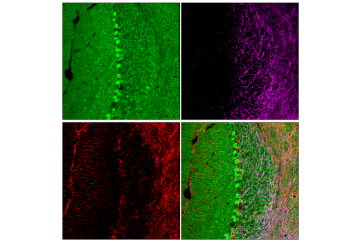 Immunofluorescence Image 3: CDK5 (D1F7M) Rabbit Monoclonal Antibody