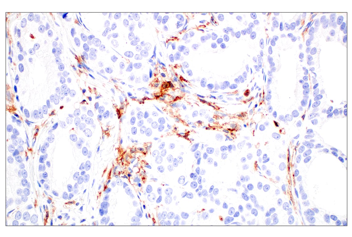 Immunohistochemistry Image 4: CD11b/ITGAM (E3J2F) Rabbit Monoclonal Antibody