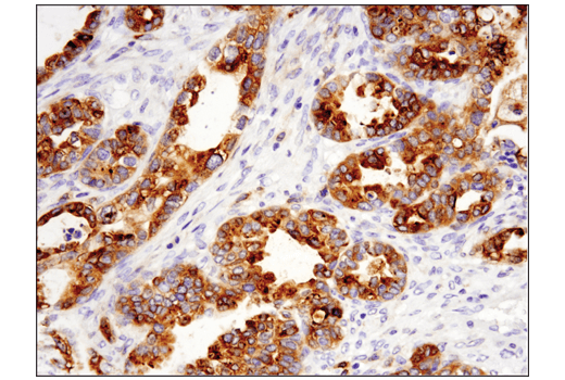 Immunohistochemistry Image 4: GPNMB (E4D7P) Rabbit Monoclonal Antibody