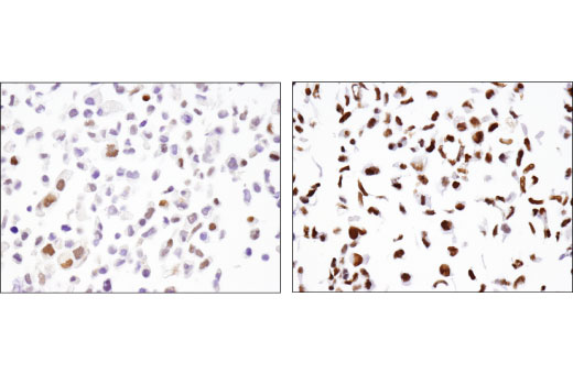 Immunohistochemistry Image 3: Fra2 (D2F1E) Rabbit Monoclonal Antibody