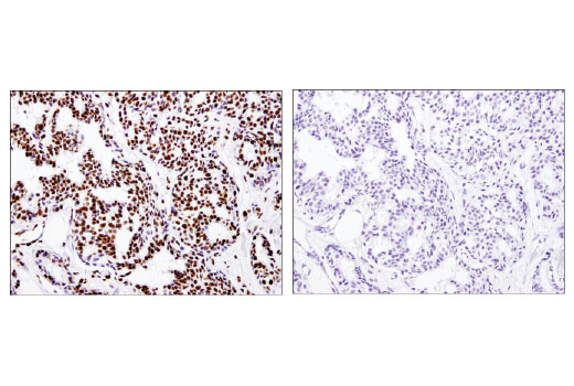 Immunohistochemistry Image 4: Acetyl-Histone H3 (Lys18) (D8Z5H) Rabbit Monoclonal Antibody