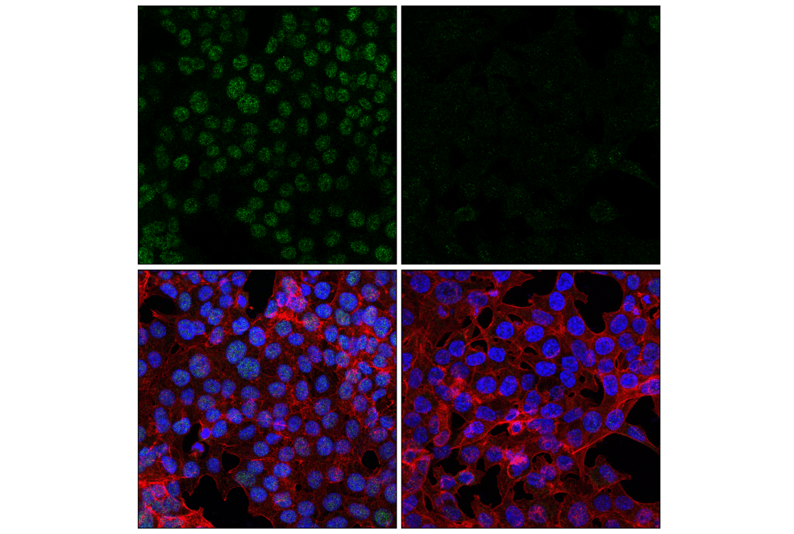 Immunofluorescence Image 1: ALKBH5 (E3F6E) Rabbit Monoclonal Antibody