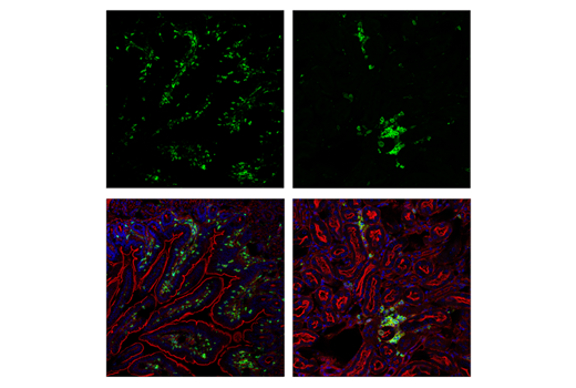 Immunofluorescence Image 1: CD45 (D3F8Q) Rabbit Monoclonal Antibody (Alexa Fluor<sup>®</sup> 488 Conjugate)