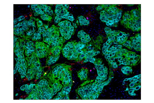 Immunohistochemistry Image 4: B7-H4 (D1M8I) Rabbit Monoclonal Antibody