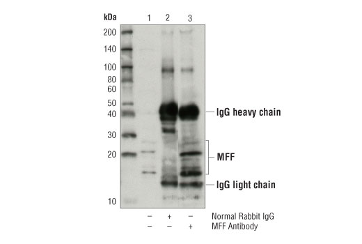 Immunoprecipitation Image 1: MFF Antibody