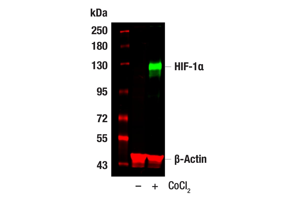 HIF-1α (D1S7W) XP® Rabbit mAb (#36169) Datasheet With Images