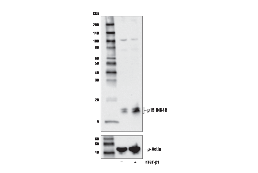 Western Blotting Image 1: p15 INK4B (E3R6S) Rabbit mAb