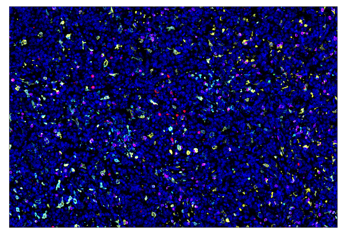 Immunohistochemistry Image 4: Cleaved Caspase-3 (Asp175) (D3E9) & CO-0118-594 SignalStar<sup>™</sup> Oligo-Antibody Pair