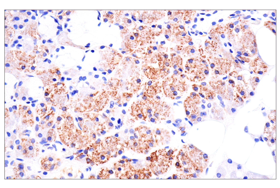 Immunohistochemistry Image 11: AMACR (F7T6V) Rabbit mAb