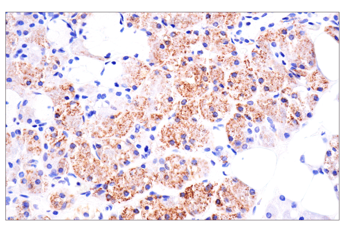 Immunohistochemistry Image 11: AMACR (F7T6V) Rabbit Monoclonal Antibody