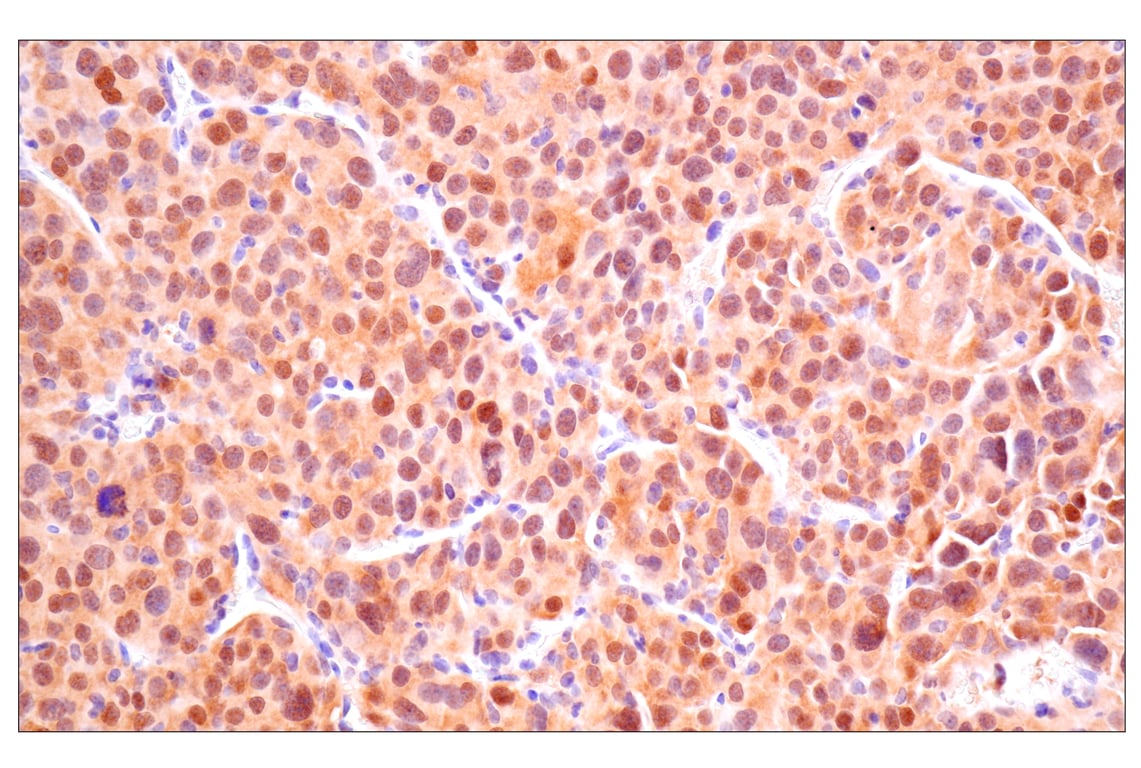 Immunohistochemistry Image 9: ACBP/DBI (E4V8V) Rabbit Monoclonal Antibody