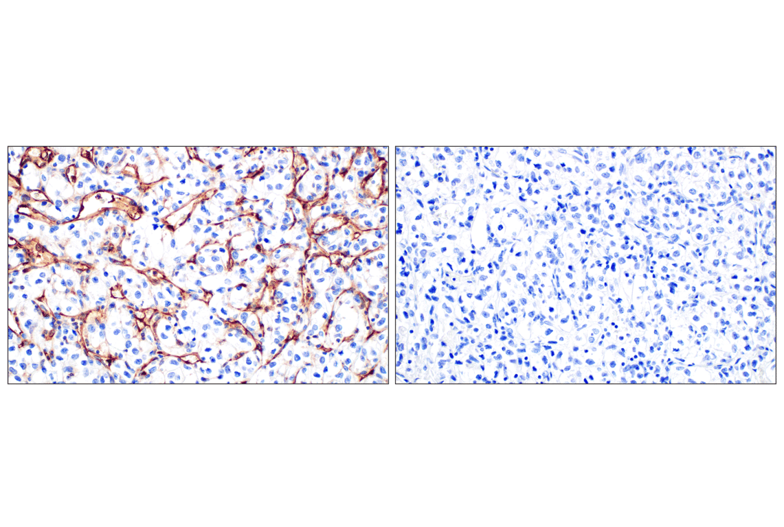 Immunohistochemistry Image 13: CD31 (PECAM-1) (F8M3S) Rabbit Monoclonal Antibody