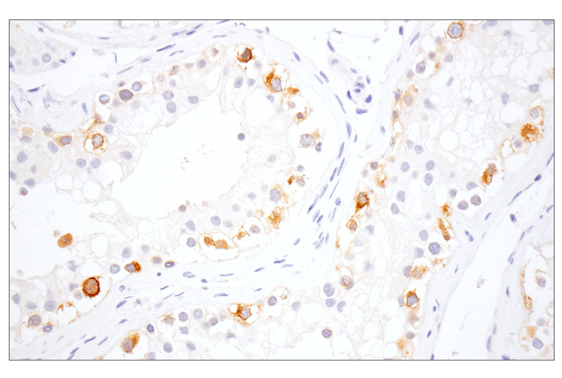 Immunohistochemistry Image 6: Eg5 (E1L3W) Rabbit Monoclonal Antibody