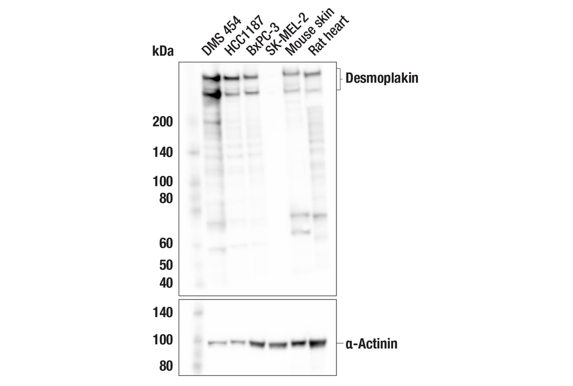 Western Blotting Image 1: Desmoplakin (F3J8Y) Rabbit Monoclonal Antibody