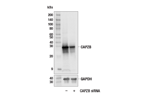 Western Blotting Image 2: CAPZB (E4H6C) Rabbit Monoclonal Antibody