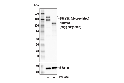 Western Blotting Image 3: GUCY2C (E6I2U) Rabbit Monoclonal Antibody