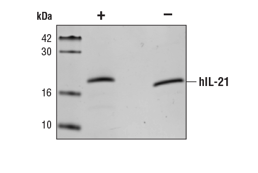undefined Image 2: Human Interleukin-21 (hIL-21) Recombinant Protein