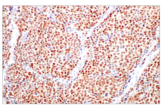 Immunohistochemistry Image 1: ASCL1 (E5S4Q) XP<sup>®</sup> Rabbit mAb