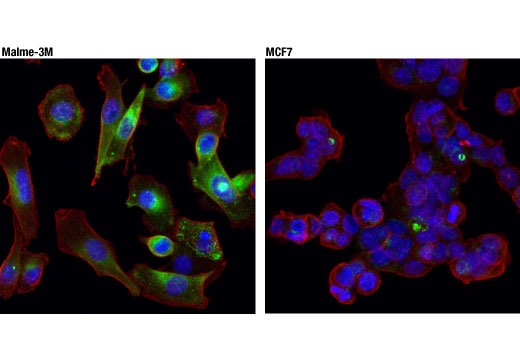 Immunofluorescence Image 1: Cathepsin B (D1C7Y) Rabbit Monoclonal Antibody (BSA and Azide Free)