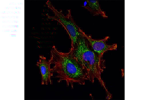undefined Image 32: Glutamine Metabolism Antibody Sampler Kit