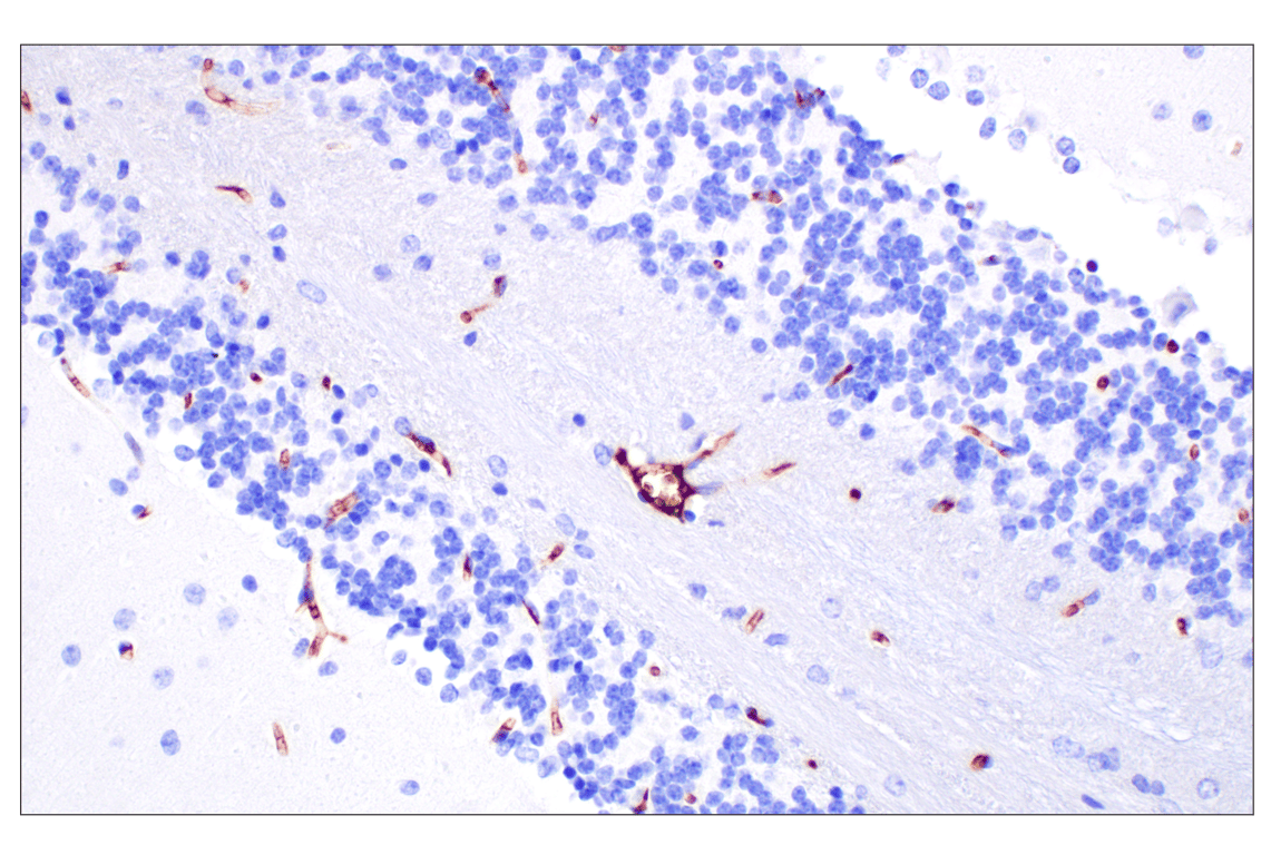 Immunohistochemistry Image 4: PNPLA3 (E7N6O) Rabbit Monoclonal Antibody (BSA and Azide Free)
