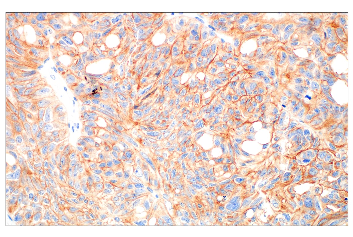 Immunohistochemistry Image 2: HER3/ErbB3 (D22C5) Rabbit Monoclonal Antibody (BSA and Azide Free)