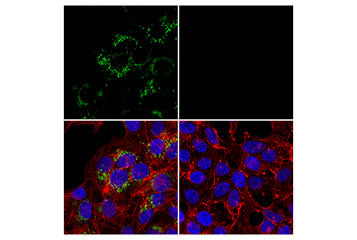 undefined Image 39: LRP1-mediated Endocytosis and Transmission of Tau Antibody Sampler Kit