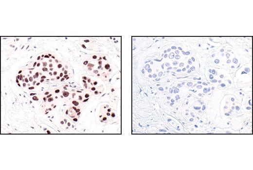 Immunohistochemistry Image 1: HP1 alpha Antibody